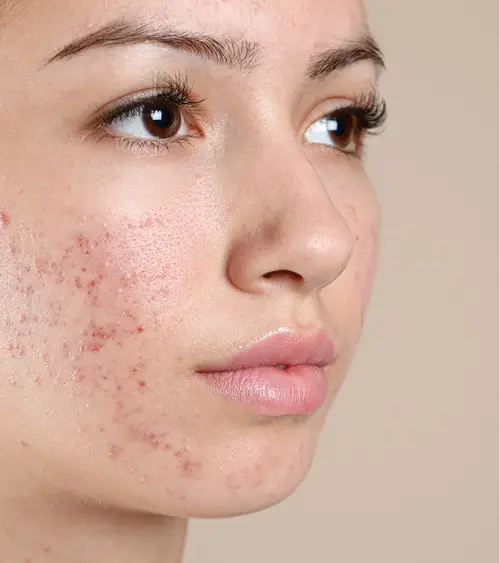 New Project New Project